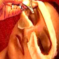 NETRATARPAN(Eye Oleation Therapy)